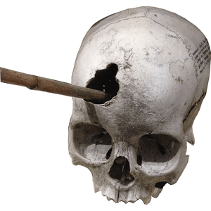 A skull with a wooden stick poked through the forehead.